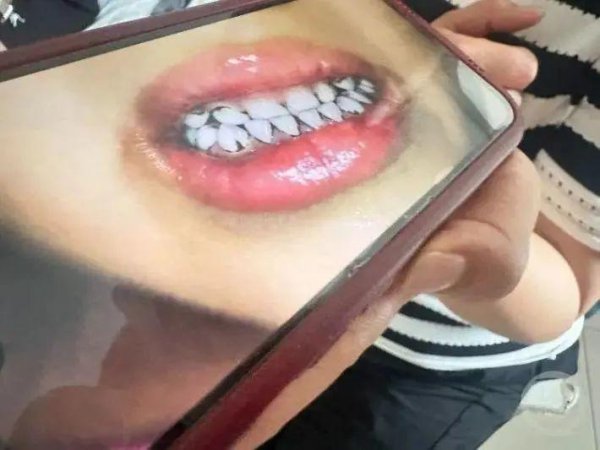 驰盈策略 甘肃233个孩子血铅事件：他们的恶，击穿人性底线
